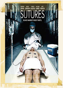 Sutures